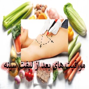 مراقبت های بعد از لیفت سینه. عکس تغذیه بعد از عمل سینه. دکتر محمدرضا آخوندی نسب