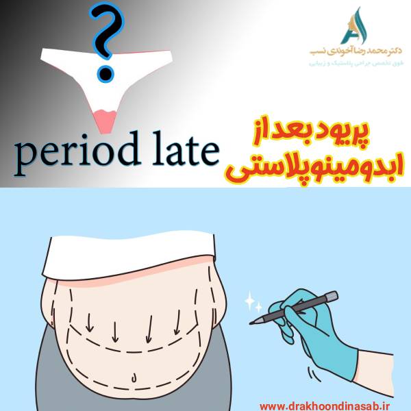 پریود بعد از ابدومینوپلاستی