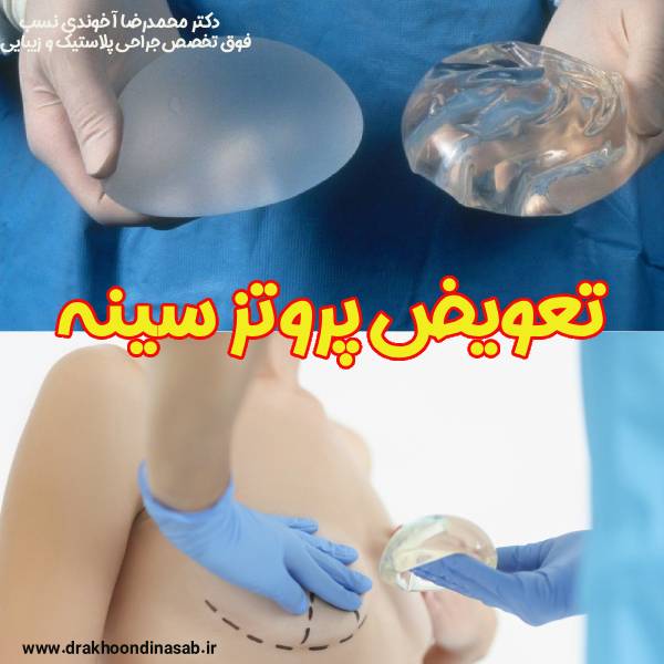 تعویض پروتز سینه - دکتر محمدرضا آخوندی نسب