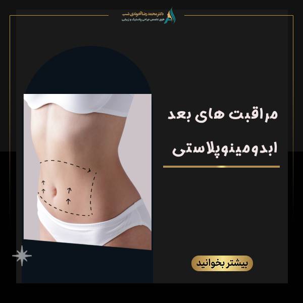 مراقبت های بعد ابدومینوپلاستی - دکتر محمدرضا آخوندی نسب