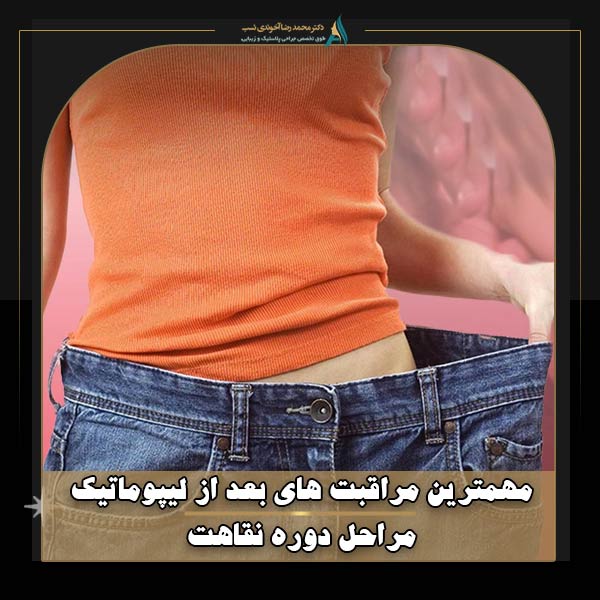 مهمترین مراقبت های بعد از لیپوماتیک چیست؟ (مراحل نقاهت)