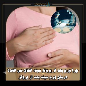 چرا ورم بعد از پروتز سینه اتفاق می افتد؟ درمان ورم سینه بعد از پروتز