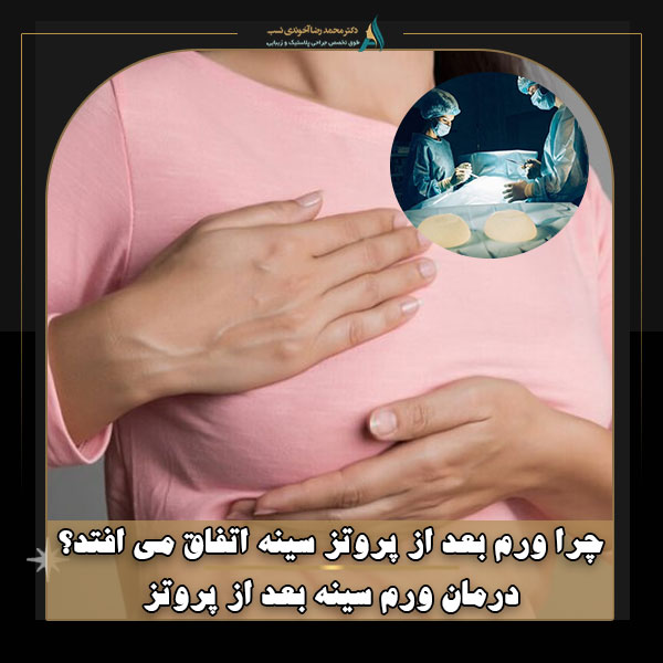 چرا ورم بعد از پروتز سینه اتفاق می افتد؟ درمان ورم سینه بعد از پروتز