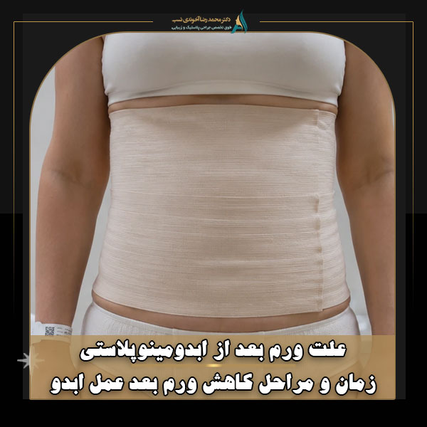 علت ورم بعد از ابدومینوپلاستی + زمان و مراحل کاهش ورم بعد عمل ابدو
