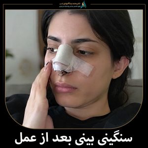 سنگینی بینی بعد از عمل + دکتر محمدرضا آخوندی نسب