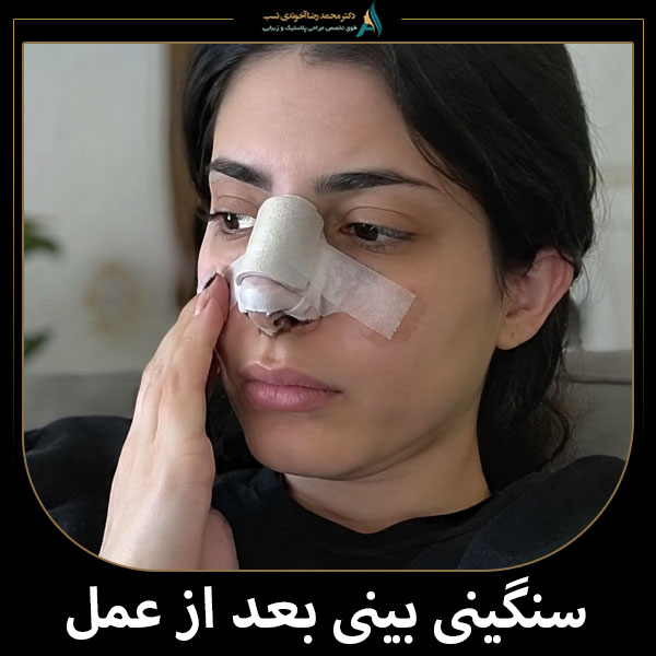 سنگینی بینی بعد از عمل + دکتر محمدرضا آخوندی نسب