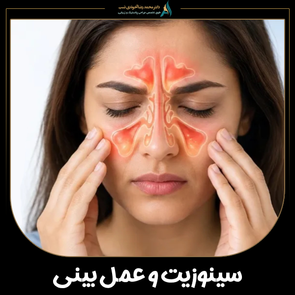 سینوزیت و عمل بینی + دکتر محمدرضا آخوندی نسب