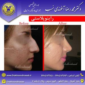 دکتر محمدرضا آخوندی نسب - راینوپلاستی