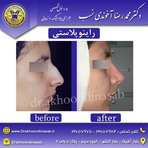 دکتر محمدرضا آخوندی نسب - راینوپلاستی