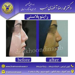 دکتر محمدرضا آخوندی نسب - راینوپلاستی