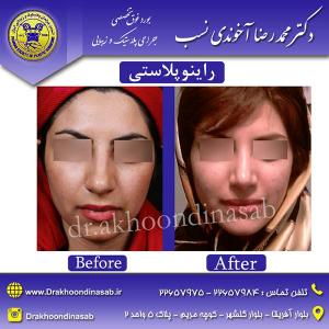 دکتر محمدرضا آخوندی نسب - راینوپلاستی