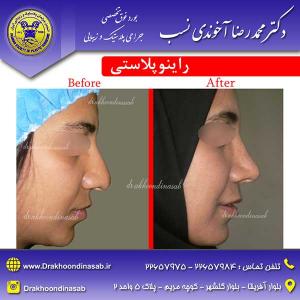 دکتر محمدرضا آخوندی نسب - راینوپلاستی