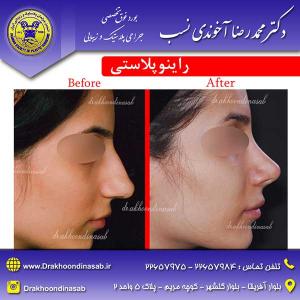 دکتر محمدرضا آخوندی نسب - راینوپلاستی