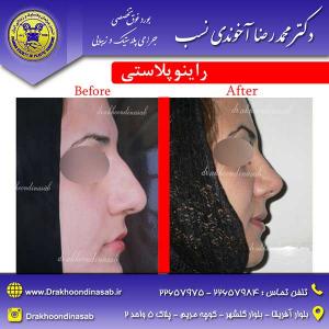 دکتر محمدرضا آخوندی نسب - راینوپلاستی