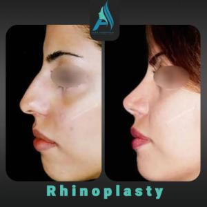 جراحی-طبیعی-9-سال-بعد