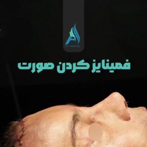 جراحی-طبییعی-بینی-106